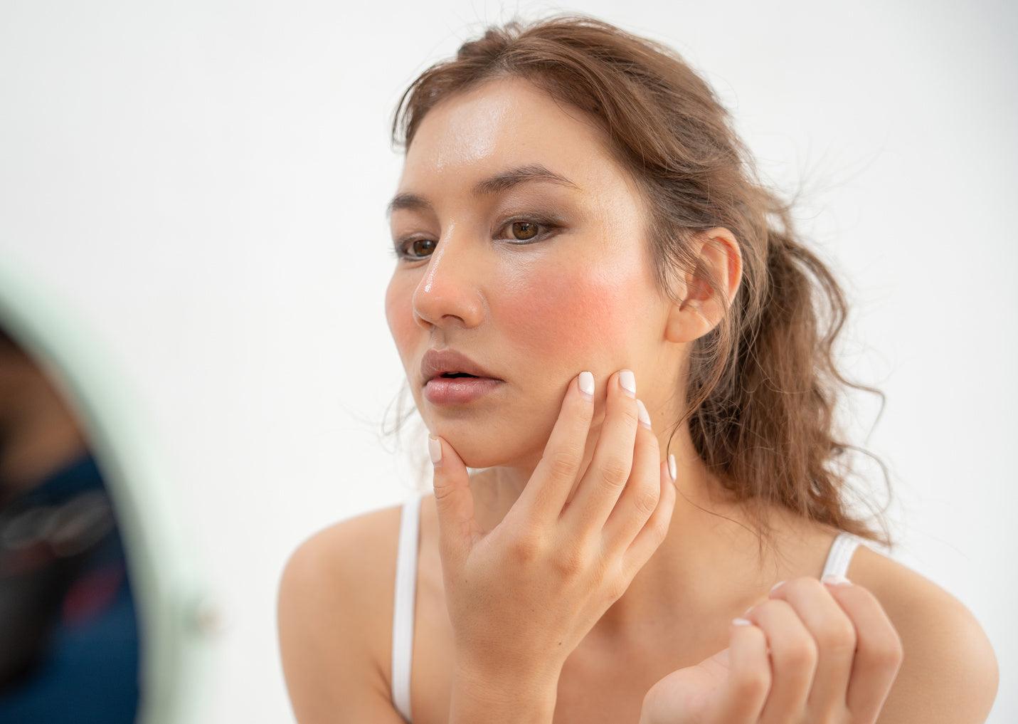 顔の赤みの原因とは? おすすめのスキンケアと対処方法 - 【公式サイト】SNOW FOX SKINCARE オンラインショップ